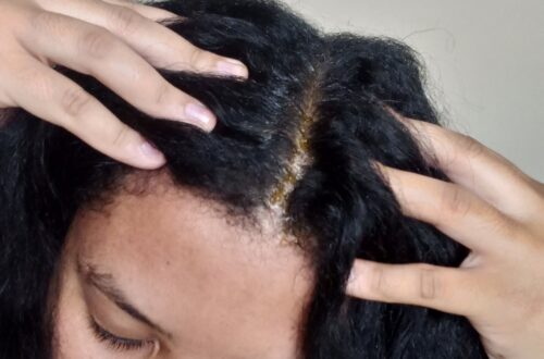 scalp massages while oiling your scalp